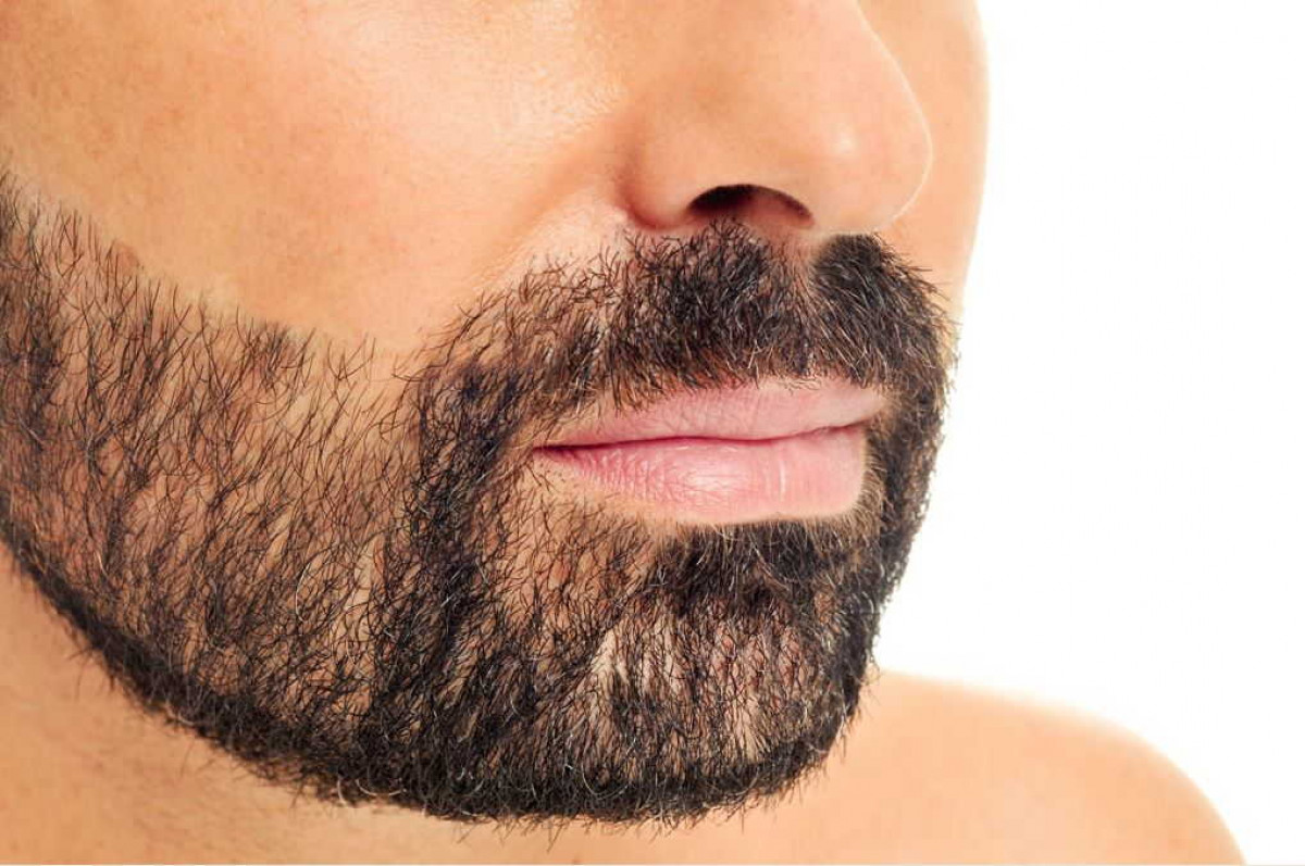 We provide electrolysis in our clinic to target odd hair, dark facial hair, grey or white facial hair. it is a permanent hair removal technique done over multiple courses.